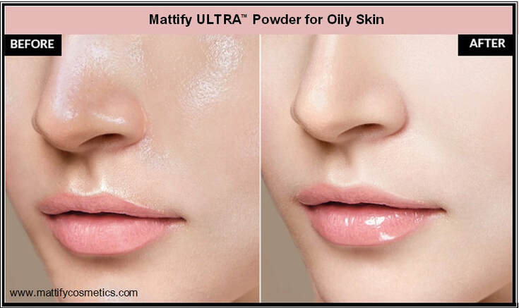 best finishing powder for acne prone skin