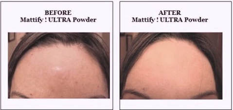 Oily skin before and after using Mattify cosmetics ultra powder best products for oily acne prone skin that won’t clog pores vegan makeup matte foundation that stays put all day using Mattify ultra setting powder without mica or bismuth 