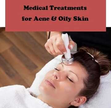 Best medical treatments for acne including chemical peels, laser therapy, Accutane, to shrink pores, stop oily skin, and prevent breakouts 