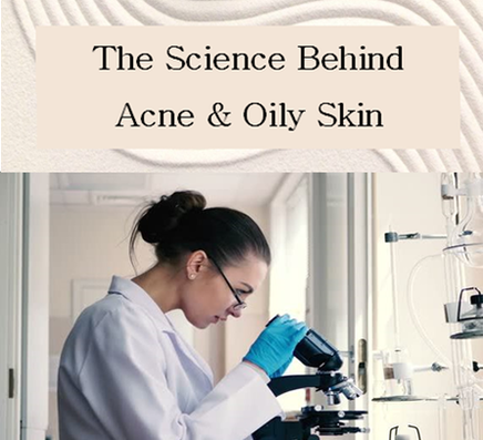 what is the scientific cause of acne breakouts and why do certain people get more zits than others 
